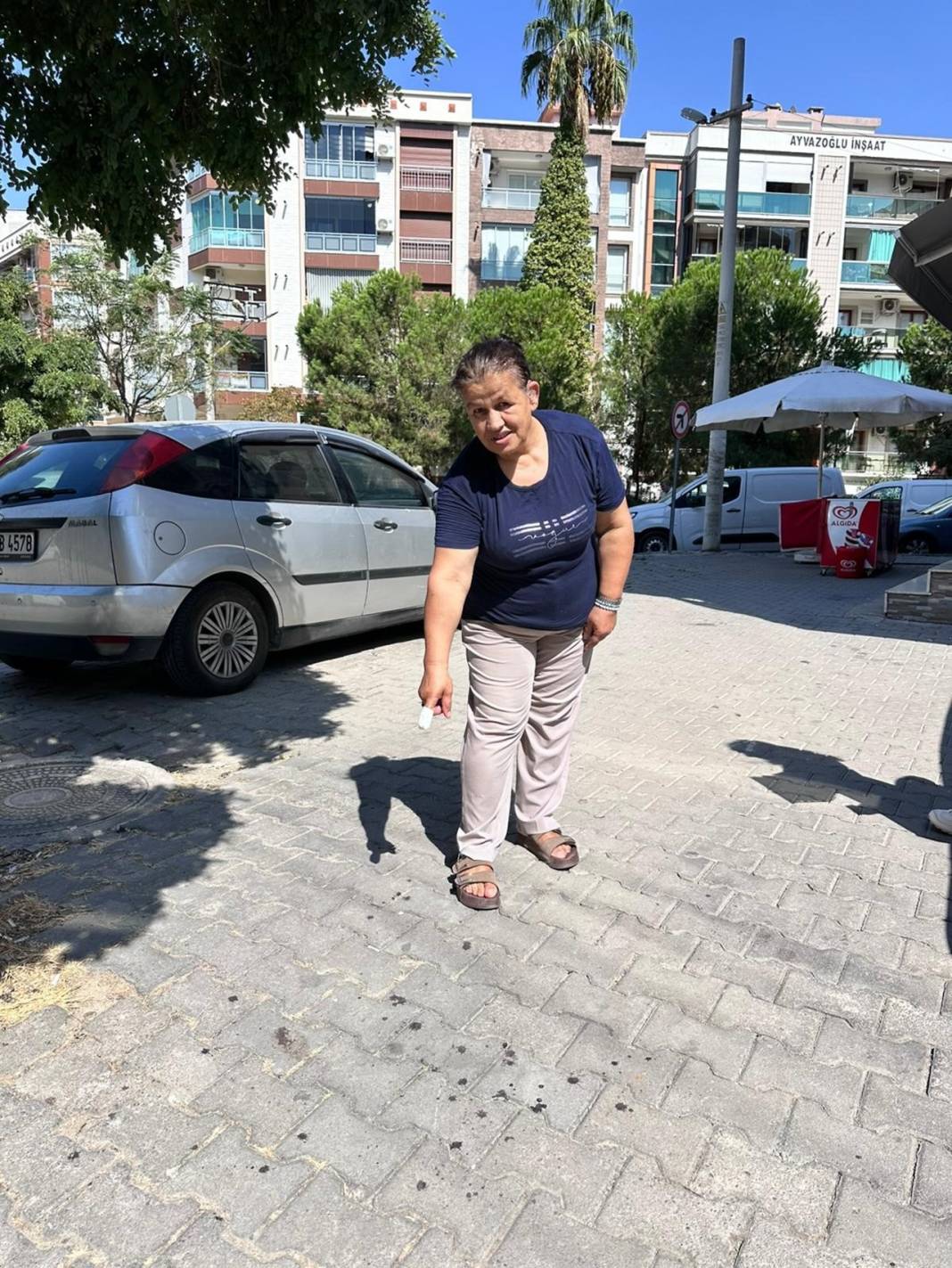 Pitbull 5 çocuk annesi kadının parmağını kopardı! 4